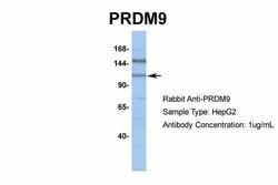 Invitrogen PRDM9 Polyclonal Antibody 100 &mu;L; Unconjugated:Antibodies,