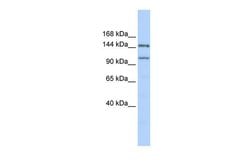 Invitrogen PRDM9 Polyclonal Antibody 100 &mu;L; Unconjugated:Antibodies,