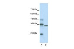 Invitrogen HES4 Polyclonal Antibody 100 &mu;L; Unconjugated:Antibodies,
