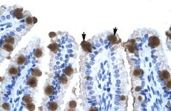 Invitrogen ZNF70 Polyclonal Antibody 100 &mu;L; Unconjugated:Antibodies,
