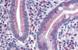 Invitrogen PXR Polyclonal Antibody 100 &mu;L; Unconjugated:Antibodies,