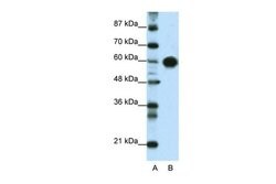 Invitrogen ZSCAN5 Polyclonal Antibody 100 μL; Unconjugated:Antibodies,