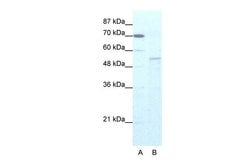 Invitrogen ZNF665 Polyclonal Antibody 100 &mu;L; Unconjugated:Antibodies,