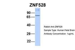 ZNF528 Polyclonal Antibody:Antibodies, Polyclonal