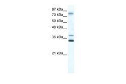 Invitrogen ZNF570 Polyclonal Antibody 100 μL; Unconjugated:Antibodies,