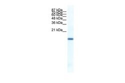 Invitrogen FERD3L Polyclonal Antibody 100 &mu;L; Unconjugated:Antibodies,
