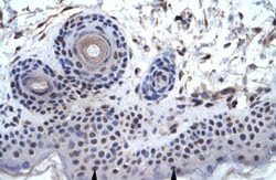 Invitrogen ZNF660 Polyclonal Antibody 100 &mu;L; Unconjugated:Antibodies,