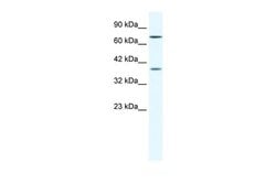 Invitrogen ZNF660 Polyclonal Antibody 100 &mu;L; Unconjugated:Antibodies,