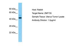 Invitrogen ZNF735 Polyclonal Antibody 100 &mu;L; Unconjugated:Antibodies,