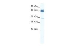 Invitrogen ZNF713 Polyclonal Antibody 100 &mu;L | Buy Online | Invitrogen&trade; | Fisher Scientific