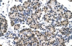 DHX9 Polyclonal Antibody:Antibodies, Polyclonal