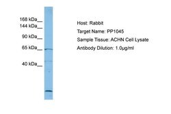 Invitrogen RECQL5 Polyclonal Antibody 100 &mu;L; Unconjugated:Antibodies,