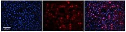 RAD54B Polyclonal Antibody 100 &mu;L | Buy Online | Invitrogen | Fisher Scientific