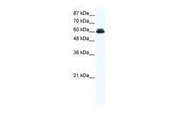 DDX27 Polyclonal Antibody:Antibodies, Polyclonal