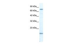 Invitrogen PGBD3 Polyclonal Antibody 100 &mu;L; Unconjugated:Antibodies,