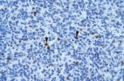 Annexin A3 Polyclonal Antibody:Antibodies, Polyclonal