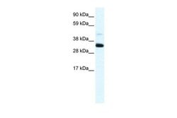 Annexin A3 Polyclonal Antibody:Antibodies, Polyclonal