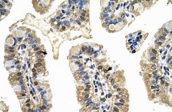 Invitrogen MCM8 Polyclonal Antibody 100 &mu;L; Unconjugated:Antibodies,