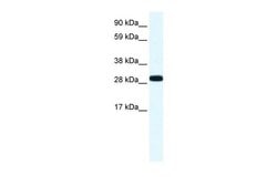 Invitrogen Annexin A4 Polyclonal Antibody 100 &mu;L; Unconjugated:Antikroppar