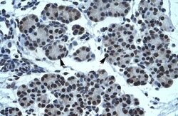 Invitrogen PTEN2 Polyclonal Antibody 100 &mu;L; Unconjugated:Antibodies,