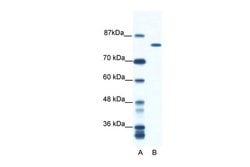 Invitrogen DHX16 Polyclonal Antibody 100 &mu;L; Unconjugated:Antibodies,