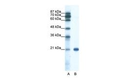 SSX2 Polyclonal Antibody:Antibodies, Polyclonal