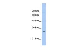 Invitrogen HMGN5 Polyclonal Antibody 100 &mu;L; Unconjugated:Antibodies,