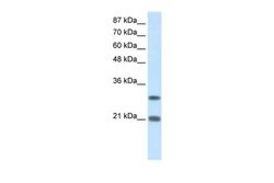 Invitrogen MSX2 Polyclonal Antibody 100 &mu;L | Buy Online | Invitrogen&trade; | Fisher Scientific