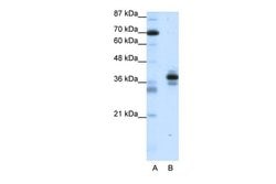Invitrogen PITX1 Polyclonal Antibody 100 &mu;L; Unconjugated:Antibodies,
