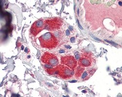 ZFP36 Polyclonal Antibody:Antibodies, Polyclonal