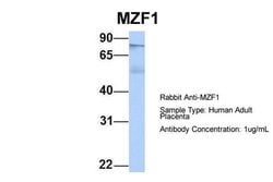 MZF1 Polyclonal Antibody:Anticuerpos