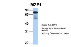 MZF1 Polyclonal Antibody:Anticuerpos