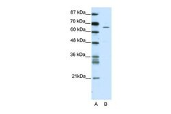 Invitrogen ZNF205 Polyclonal Antibody 100 &mu;L | Buy Online | Invitrogen&trade; | Fisher Scientific