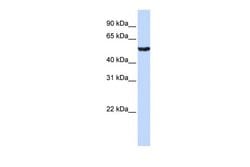 Invitrogen HNF6 Polyclonal Antibody 100 &mu;L; Unconjugated:Antibodies,