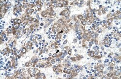 Invitrogen DLX5 Polyclonal Antibody 100 &mu;L; Unconjugated:Antibodies,
