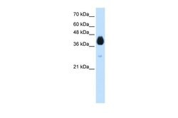 Invitrogen DLX5 Polyclonal Antibody 100 &mu;L; Unconjugated:Antibodies,