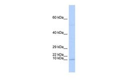 Invitrogen™ TAL2 Polyclonal Antibody