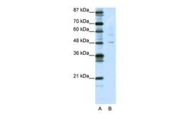 Invitrogen PLAGL1 Polyclonal Antibody 100 &mu;L; Unconjugated:Antibodies,