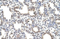 Invitrogen ZNF195 Polyclonal Antibody 100 &mu;L; Unconjugated:Antibodies,