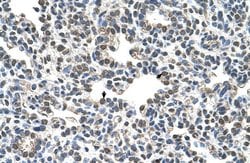 Invitrogen CIZ1 Polyclonal Antibody 100 &mu;L; Unconjugated:Antibodies,