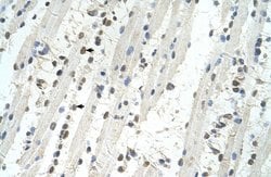 TRIM32 Polyclonal Antibody:Antibodies, Polyclonal