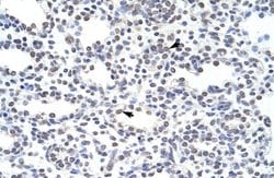 Invitrogen ILF3 Polyclonal Antibody 100 &mu;L; Unconjugated:Antibodies,