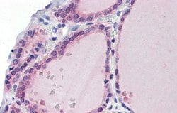 Invitrogen LDOC1 Polyclonal Antibody 100 &mu;L; Unconjugated:Antibodies,
