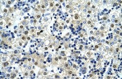 NFYC Polyclonal Antibody:Antibodies, Polyclonal