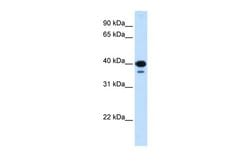 NFYC Polyclonal Antibody:Antibodies, Polyclonal