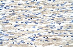 Invitrogen CBX6 Polyclonal Antibody 100 &mu;L; Unconjugated:Antibodies,