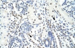 POGZ Polyclonal Antibody:Antibodies, Polyclonal