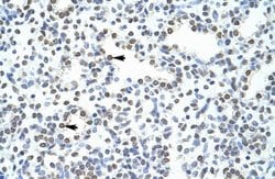 POGZ Polyclonal Antibody:Antibodies, Polyclonal