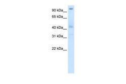 POGZ Polyclonal Antibody:Antibodies, Polyclonal