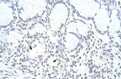 Invitrogen ZNF580 Polyclonal Antibody 100 &mu;L; Unconjugated:Antibodies,